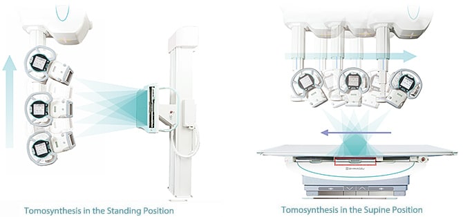 Tomosynthesis (Digital Multislice Tomography) (Option)