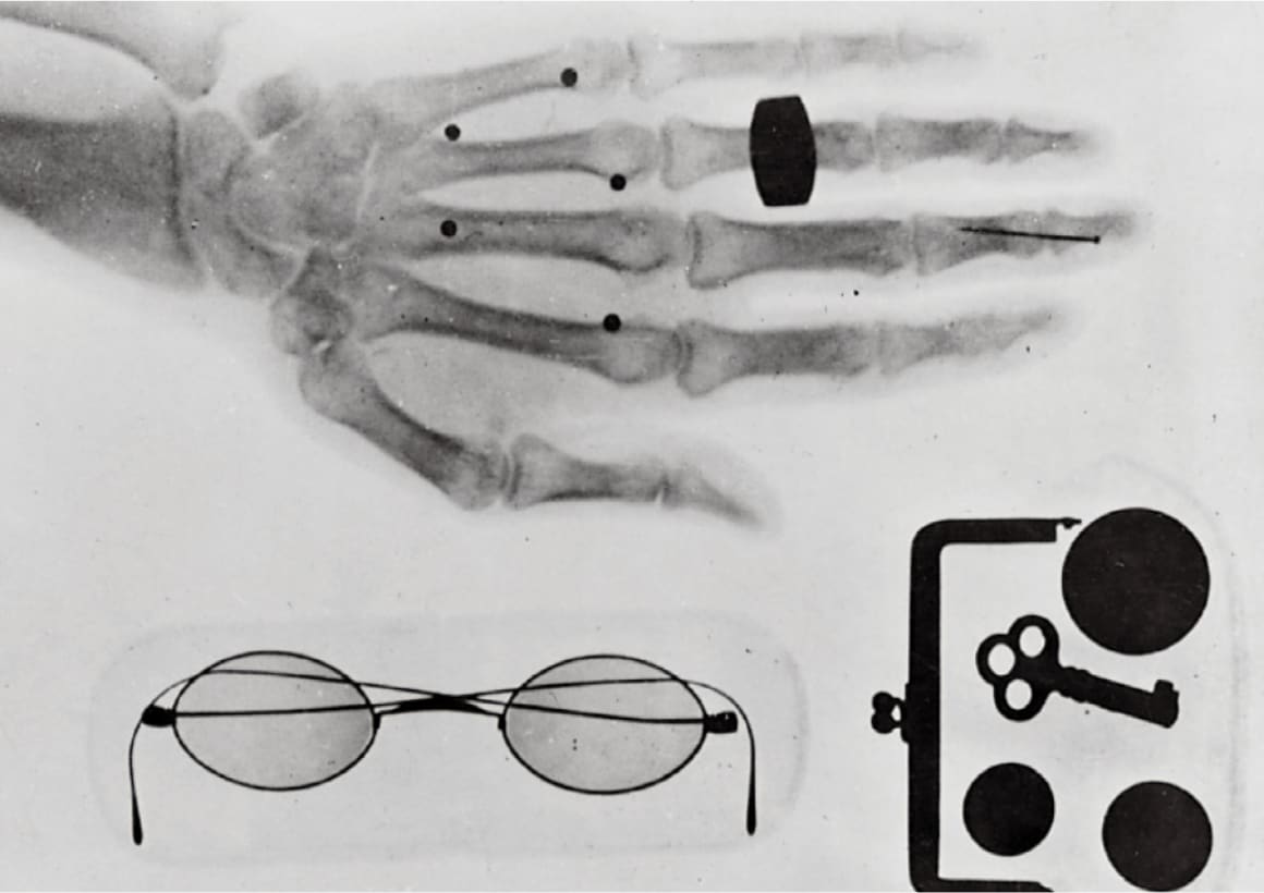 Early X-ray photograph