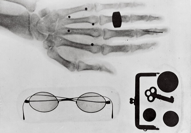 Japan’s first X-ray photographs