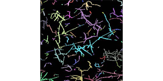 Evaluation of fiber length and dispersibility of cellulose nanofibers