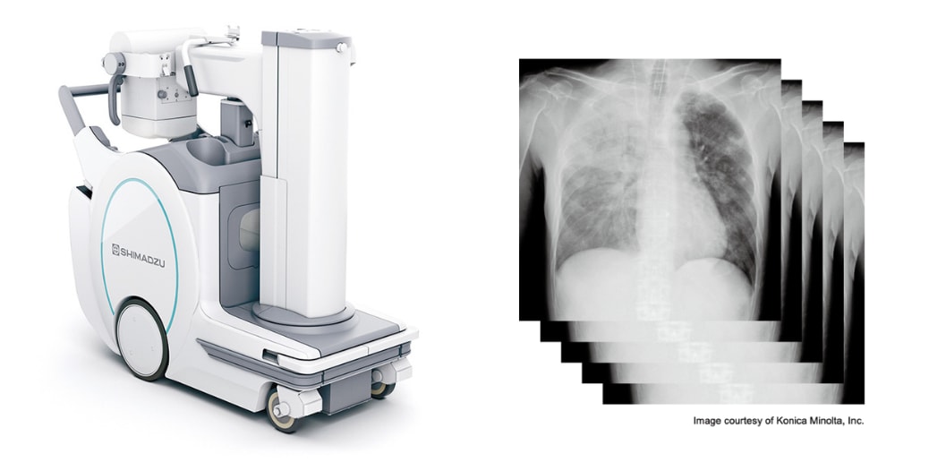 Izquierda: MobileDaRt Evolution MX8 Version tipo k; derecha: ejemplo de imágenes de radiografía en serie