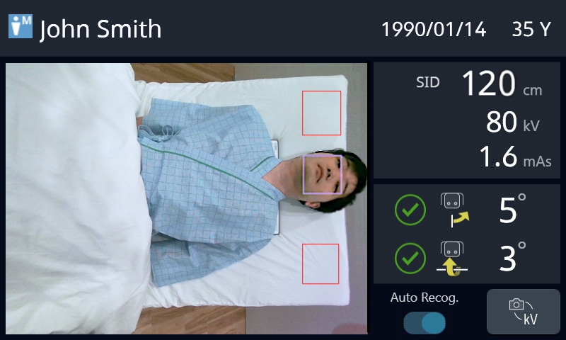 Patient information, imaging conditions, and images acquired with the 3D camera (optionally available) displayed on the second monitor (c type)