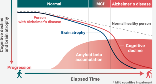 Brain and Mind : Research Areas : KYOLABS : SHIMADZU CORPORATION